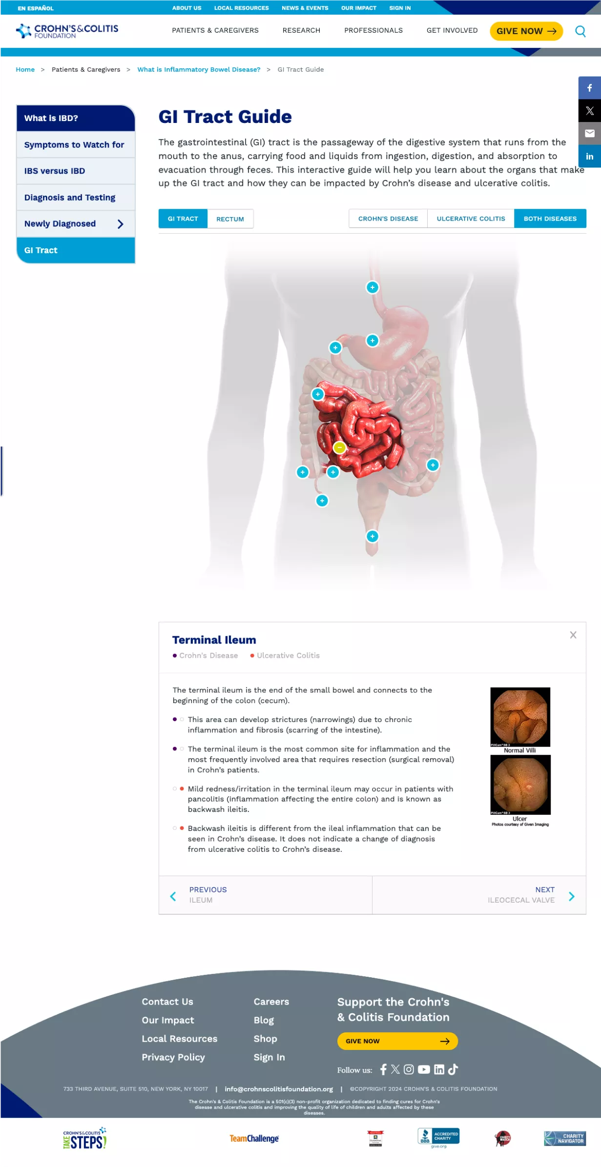 Summer Impact Report 2024 | Crohn's & Colitis Foundation
